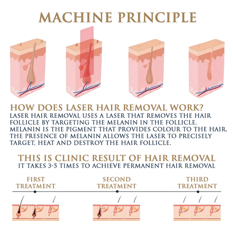 Skin Monarch Quantum Pro Diode & Picosecond Laser - BVShop