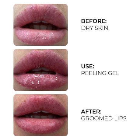 AS Company Peeling Gel (Active Oxygen) 17ml