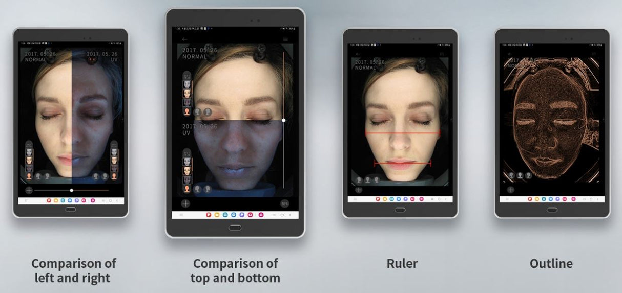 BomTech A-ONE W Skin Analyzer - BVShop