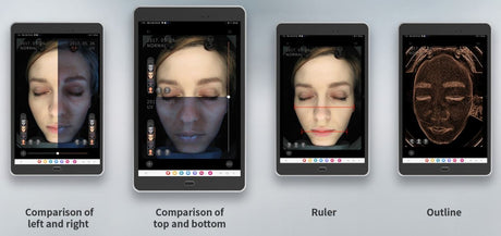 BomTech A-ONE W Skin Analyzer - BVShop